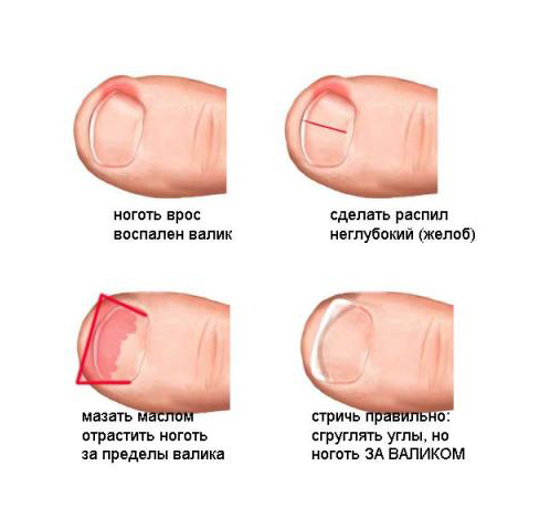 Хипстерская прическа для девушки Хипстерская прическа для девушки