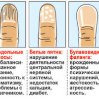 Нуждающиеся в жилье: основания для улучшения жилищных условий Настенные кармашки для хранения своими руками: фото