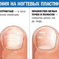 Экзодерил владикавказ цена