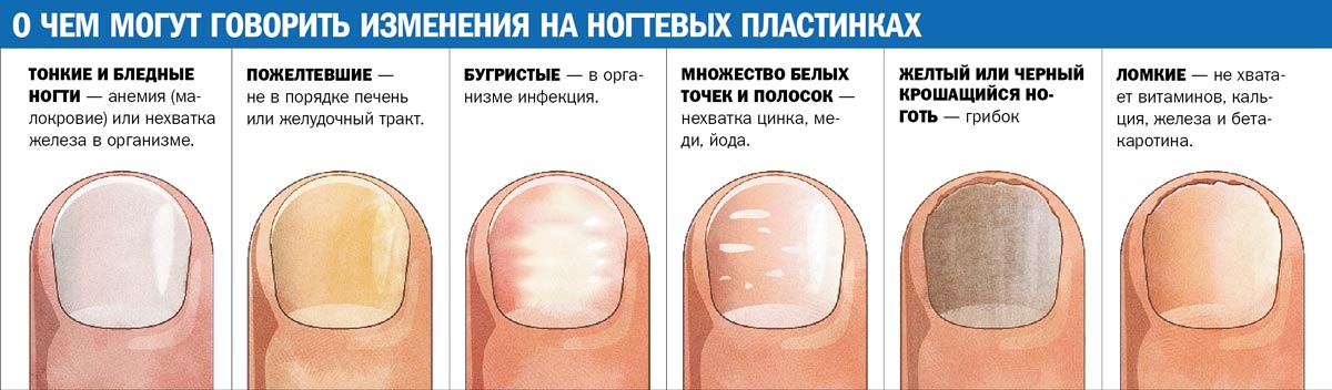 эффективное лекарство от паразитов эффективное лекарство от паразитов