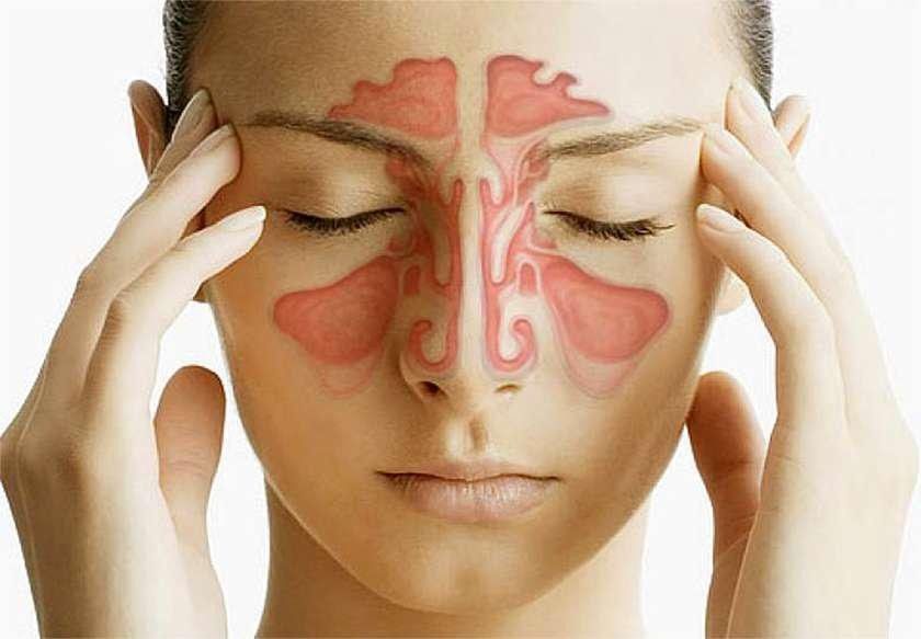 Грибок в носу: симптомы ФОТО, лечение мазями, каплями и народными средствами