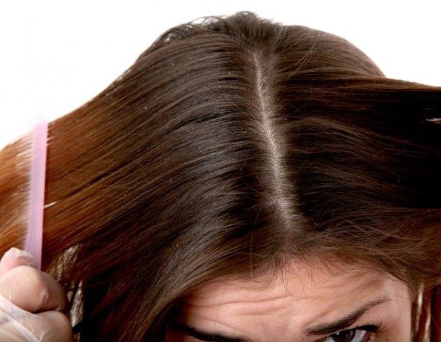 Грибок волосистой части головы - показание к использованию Экзодерила