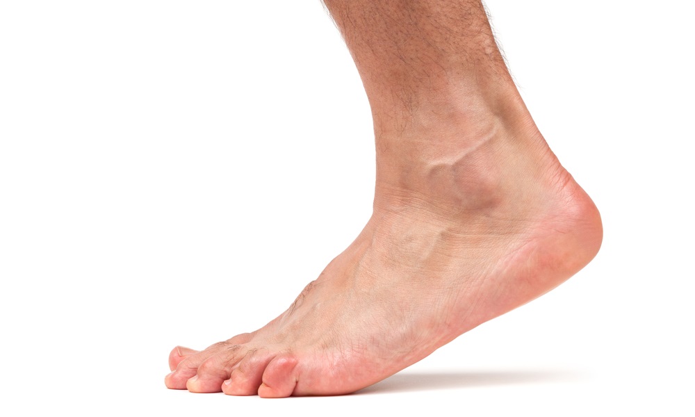 Проблема грибка ногтей на ногах