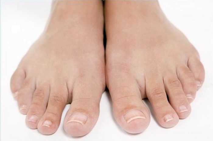 Уход за ногтями ногами лечение грибка ногтей